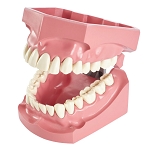 960 Articulated Enlarged Model with 32 Removable Teeth